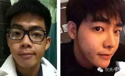 男网红整容脸吃瓜视频,吃瓜群众热议的整形真相 第1张 男网红整容脸吃瓜视频,吃瓜群众热议的整形真相 第1张